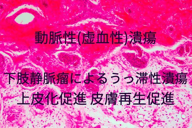 ヒトの皮膚汗腺画像